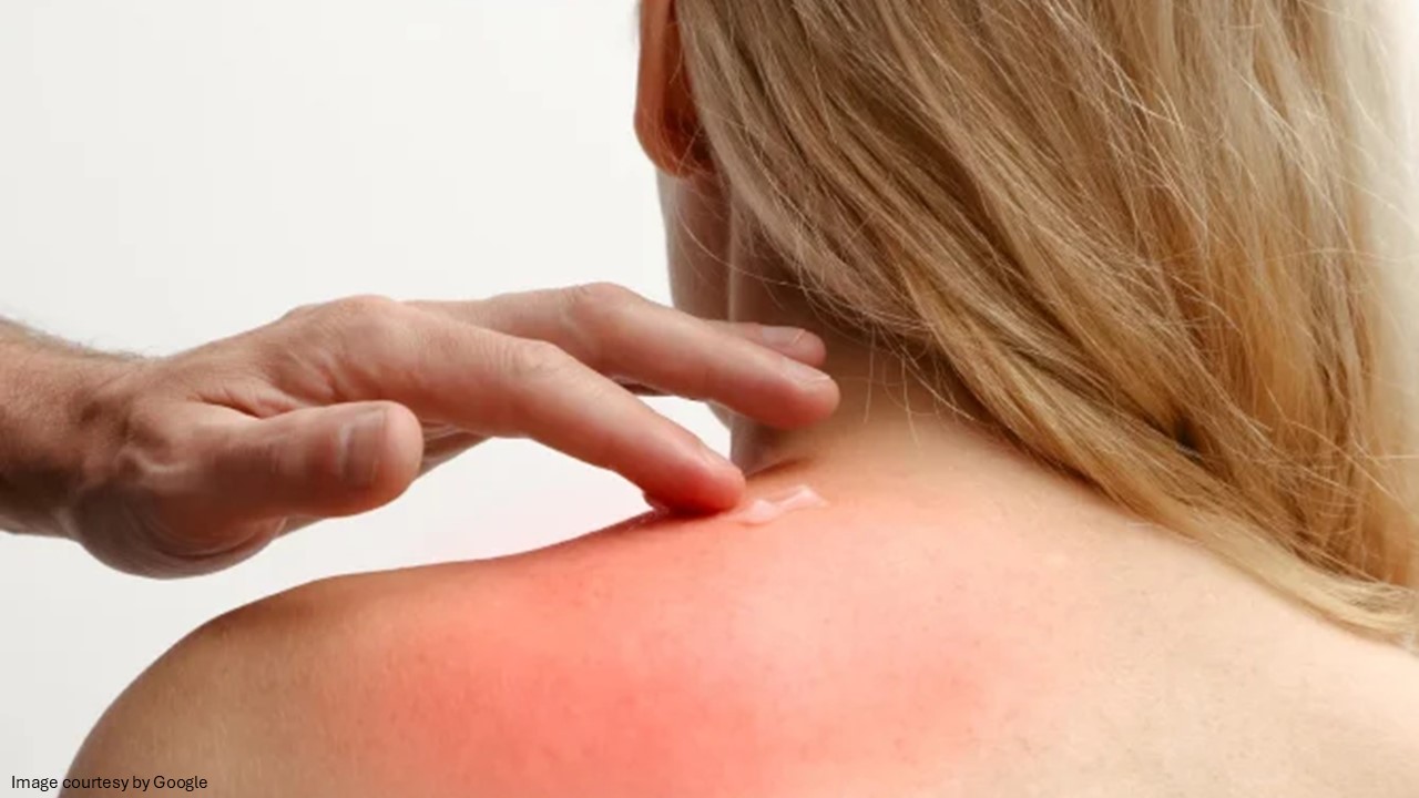 Topical vs Oral Pain Relief