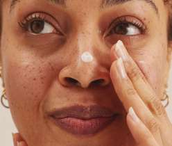 Tretinoin and what to expect