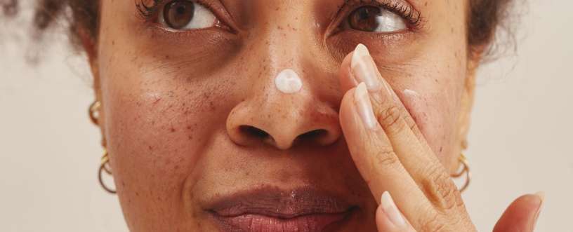 Tretinoin and what to expect