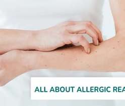 Immune System Reaction During an Allergic Reaction