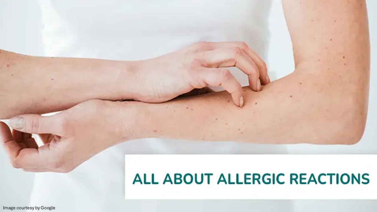 Immune System Reaction During an Allergic Reaction