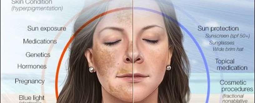 how to use triluma cream