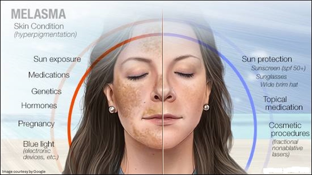 how to use triluma cream