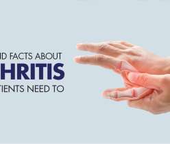 Facts Around Arthritis
