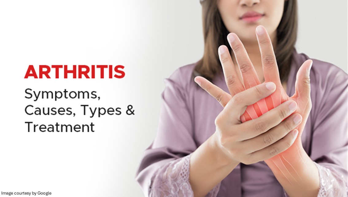 Myths Around Arthritis