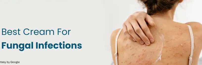 Best cream for antifungal