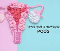 Semaglutide for PCOS showing potential effects on weight loss, fertility and hormonal health