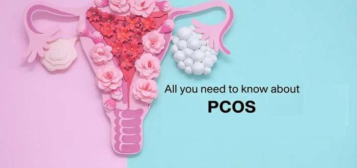 Semaglutide for PCOS showing potential effects on weight loss, fertility and hormonal health