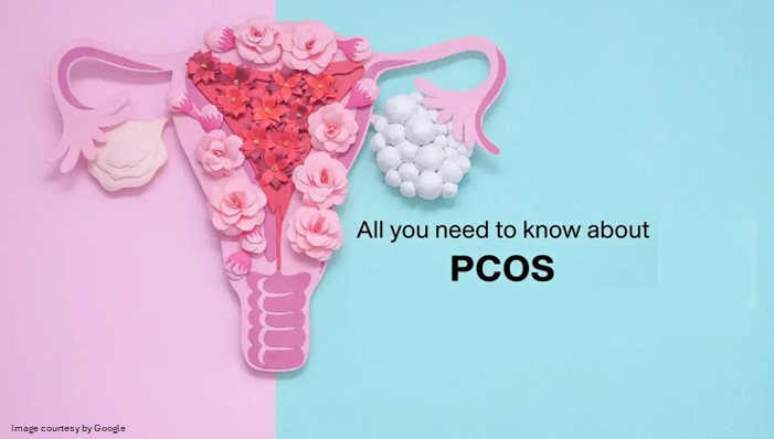 Semaglutide for PCOS showing potential effects on weight loss, fertility and hormonal health