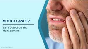 What Is Mouth Cancer