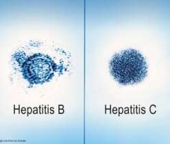 Chronic Hepatitis B Treatment