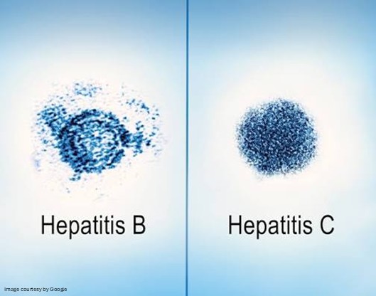Chronic Hepatitis B Treatment