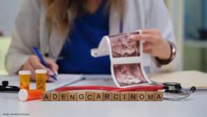 What Is Adenocarcinoma
